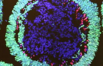 organoids কি?